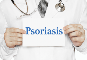 A doctor holding a white sign with the words psoriasis on it